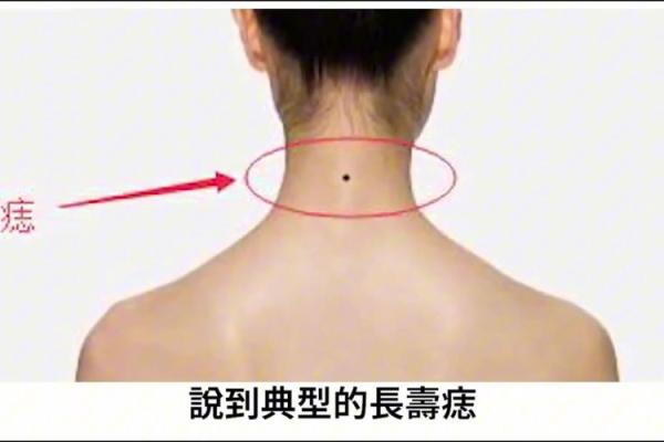痣相大揭秘：肚脐右下痣，揭秘你的财运和命运！