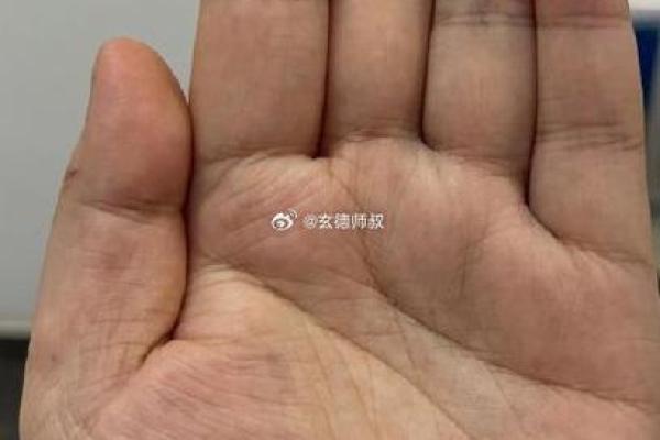 手相大拇指横纹：掌握人生运势的关键线索