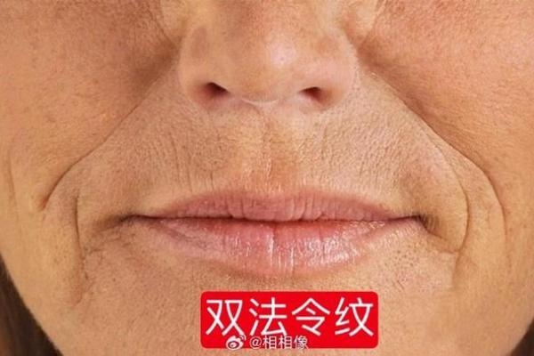 面相大揭秘：揭秘命里注定牢狱纹的惊人秘密！