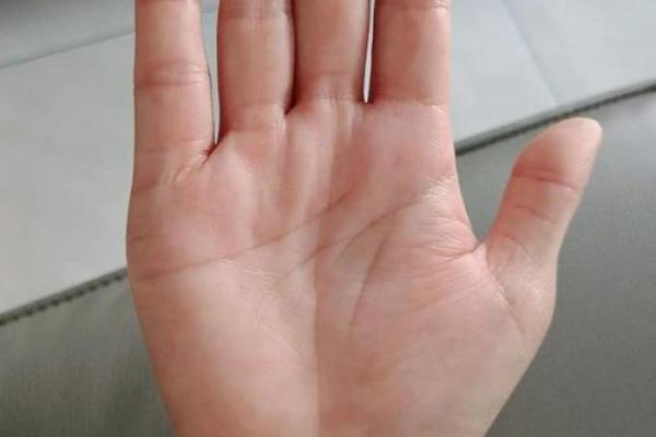 短指奥秘：揭秘小拇指粗短的独特魅力