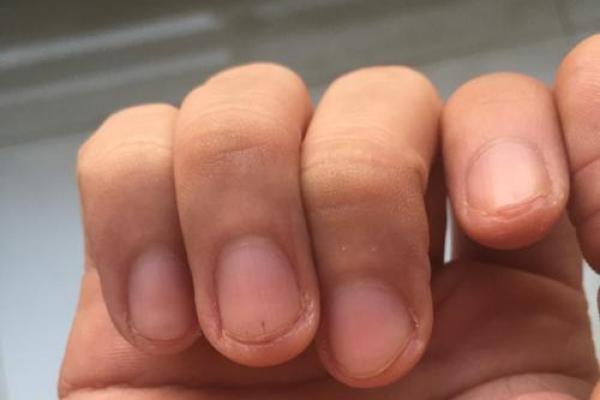 指尖的幸运符：右手中指痣背后的运势秘密