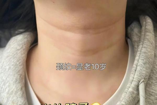 面相颈纹显福禄