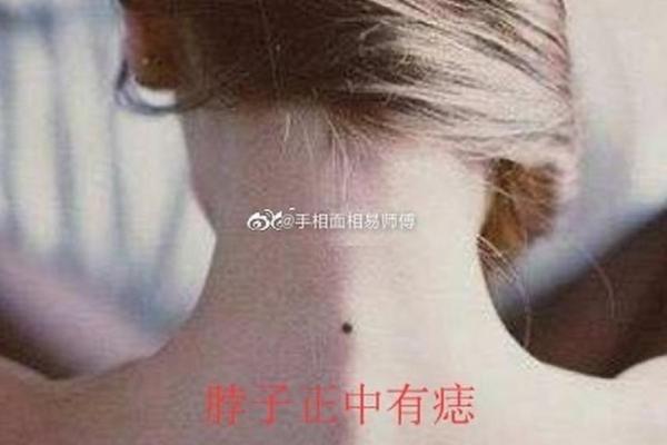 痣相揭秘：脖子上的痣暗示什么运势