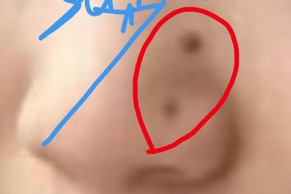 男人的破财痣到底有多可怕？