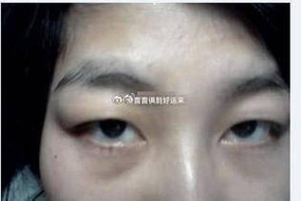 肿眼袋面相揭示：财富与健康的多面镜子