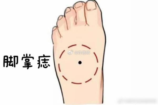 痣相脚图解宝典：脚底痣相预示未来，快来对照！