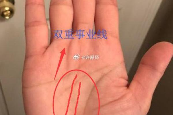 手相揭秘：黑痣背后的命运秘密