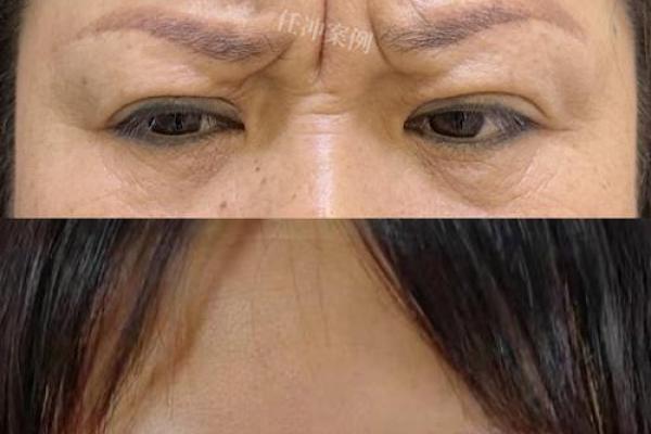 薄命女子面相解析：命运多舛的面相特征揭秘