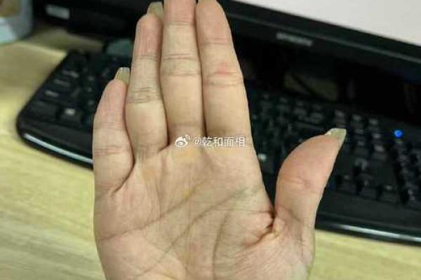 指尖密码：短粗小拇指的神秘力量