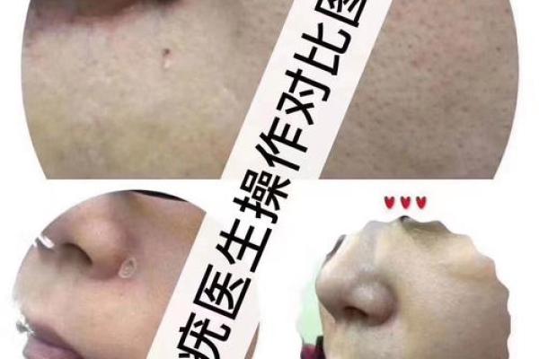 痣相破财真相大揭秘！你的痣会带来财运还是败运？