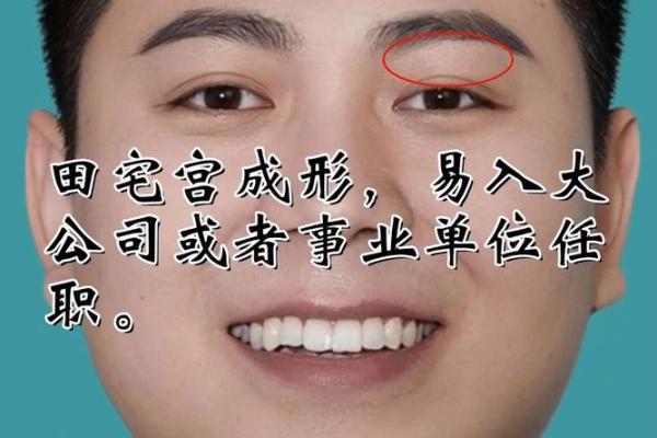 你的田宅痣在哪？一探财运旺衰！