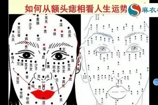 头部痣相揭秘：男人运势的神秘密码！
