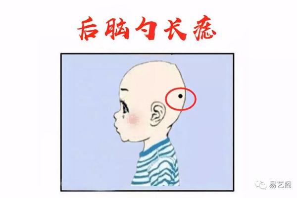 头部痣相揭秘：男人运势的神秘密码！