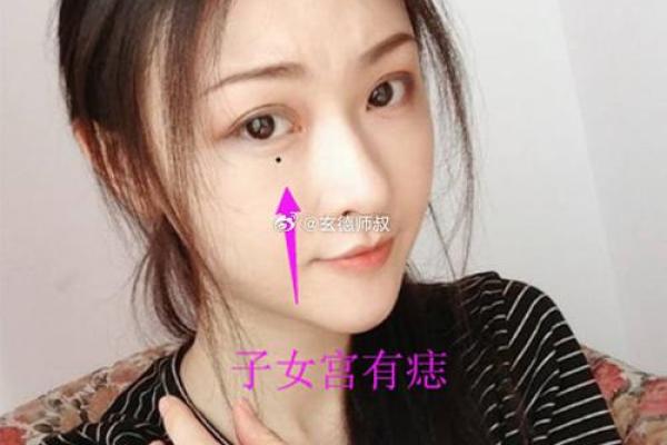 眉间痣相，揭秘人生赢家！