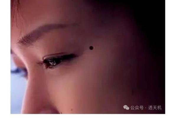 痣相相吸，双碰成就佳缘