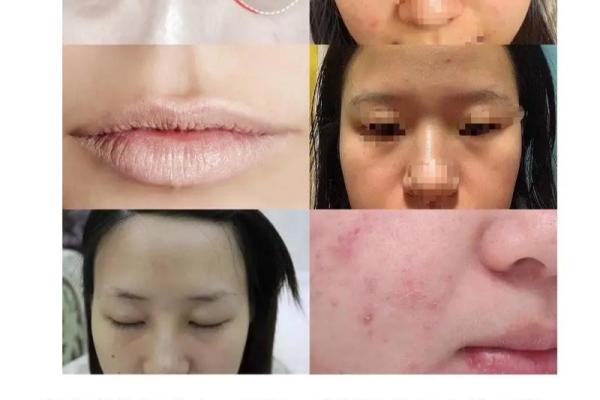 面相揭秘：年龄与运气的微妙关系