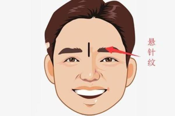 印堂痣相揭秘：财运亨通的秘密武器！