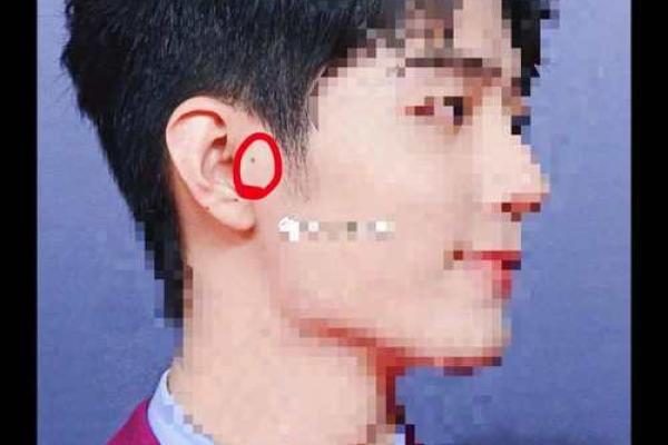 耳根痣相解码：揭秘命运之谜