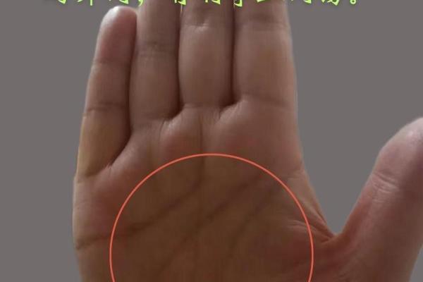 痣相揭秘：女人手上痣的美丽与命运之谜