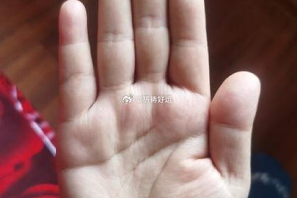 手相揭秘：手术刀在手，财富滚滚来！