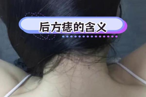 神秘诱惑：颈部痣相解码，揭秘美丽与魅力的秘密！