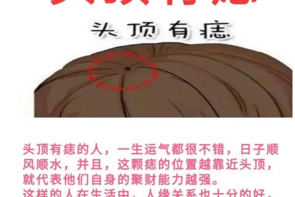痣相里的生死密码：揭秘命短痣相背后的秘密！