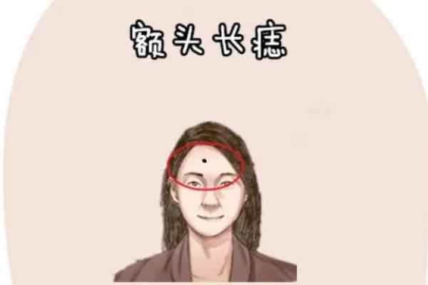 美丽痣相攻略：女生头顶痣的穿搭秘诀