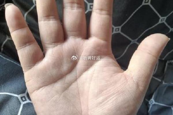 肚纹揭秘：命运轨迹尽在掌握