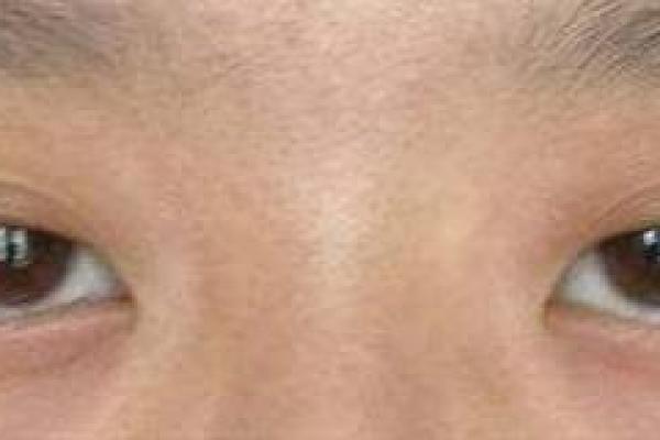 眼角垂丝，魅力四溢的秘密面相揭秘！