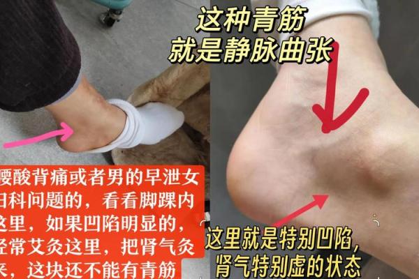 脚踝宽厚，财运亨通，揭秘肥脚踝面相的惊人秘密！