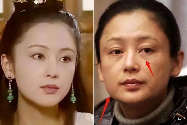 未老先衰的面相揭秘：看透岁月的秘密！