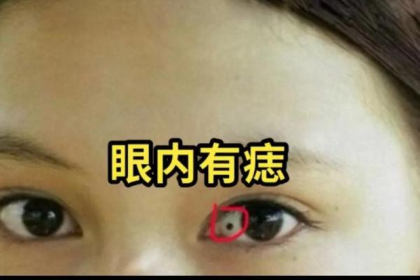 眼中有痣更迷人，揭秘痣相美女的神秘魅力