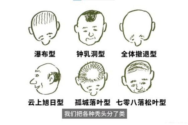 三十秃顶面相，揭秘男人魅力转折点！