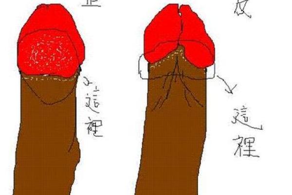 龟头上的神秘痣，男人都想知道的秘密！