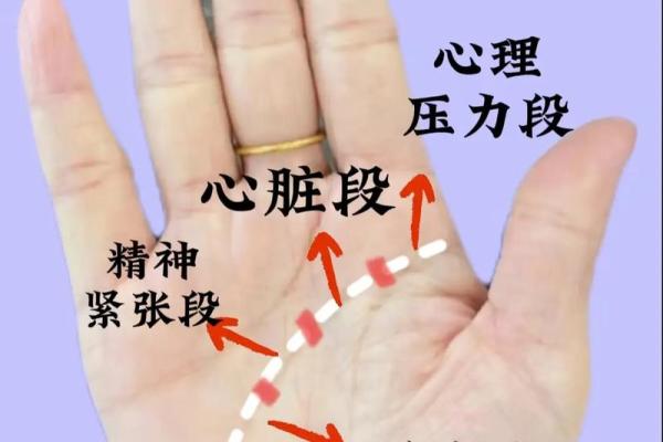 解锁健康密码：手相内脏图揭秘