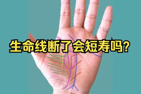 生病线在手，健康运势揭秘！