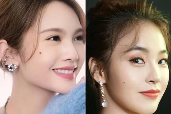 发际痣不再是烦恼：揭秘如何打造个性发型