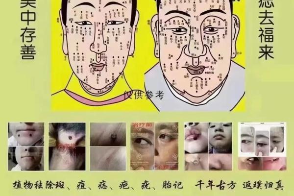 看痣相识命运：法令线痣相背后的秘密