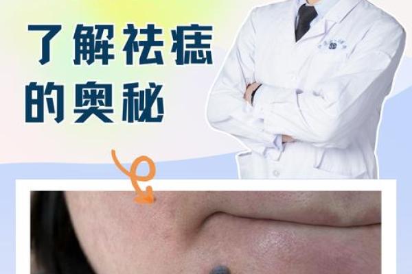 痣相能信吗？专家揭秘其中的奥秘！