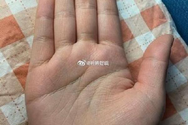神秘锁链纹手相：揭秘你的宿命密码，解锁命运之门！