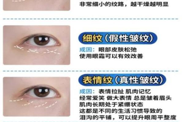 眼角纹重揭秘：面相中的岁月痕迹与人生智慧