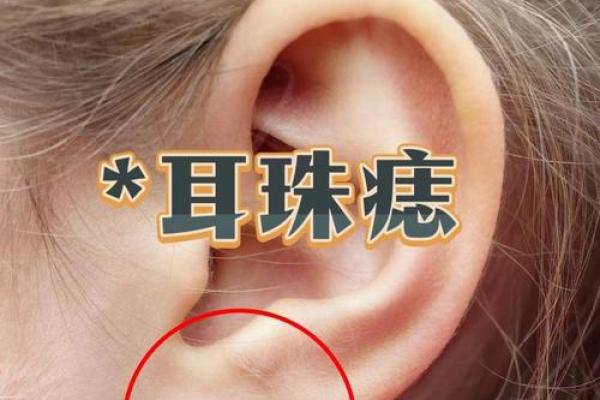 面部痣相大揭秘，女人运势与性格的秘密，赶快收藏！