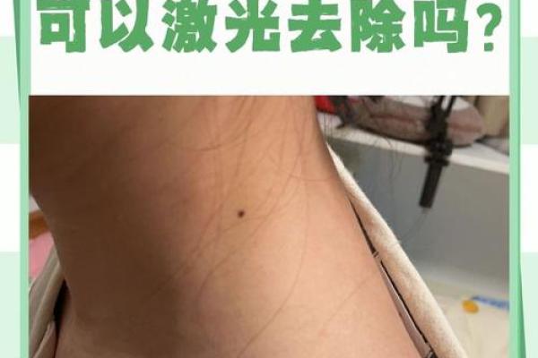 翻脸无情，脖子上的痣暴露性格！