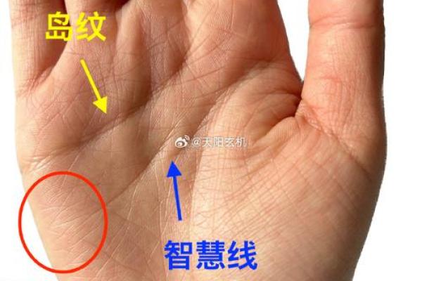 手相奥秘：痣的位置，透露你的天赋与运势