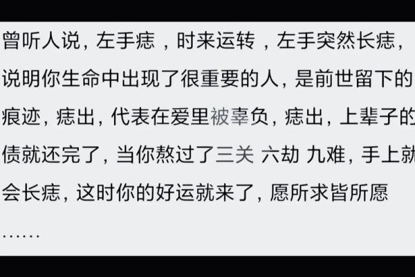 独家揭秘：男手长痣的神奇命运预兆