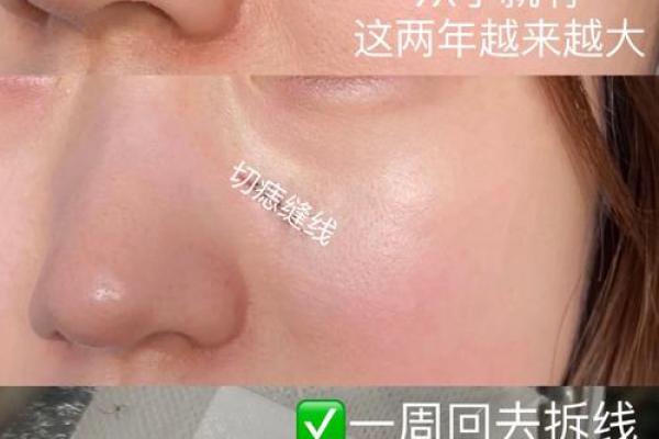 痣相解析：长胡子的痣，是福是祸？
