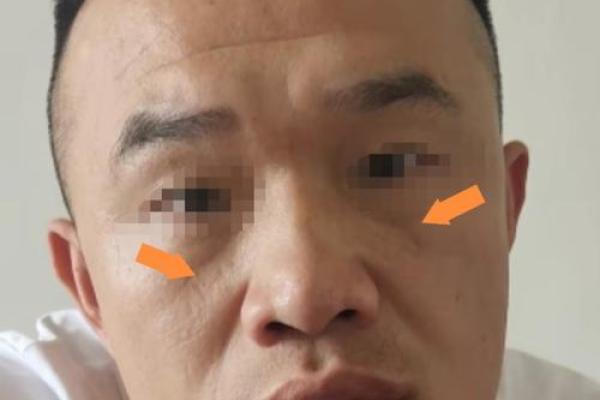 面相揭秘：颧骨高低与命运起伏的神秘关联