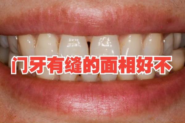 上门牙挤压面相揭秘