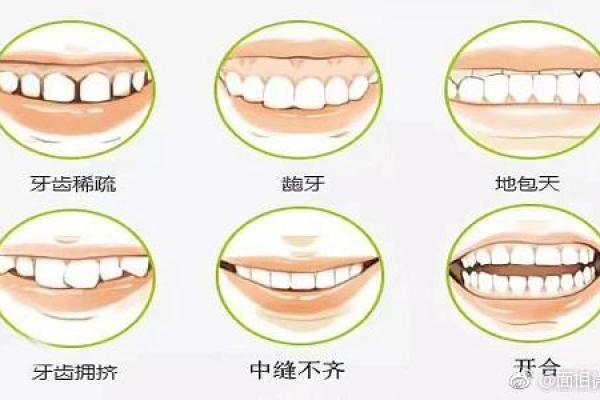 上门牙挤压面相揭秘