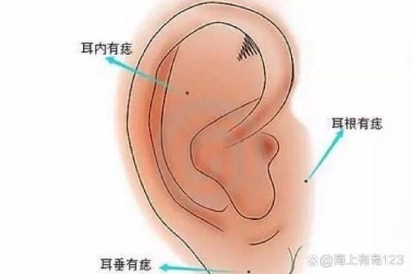 痣相女神的秘密：脸蛋与耳朵的完美搭配